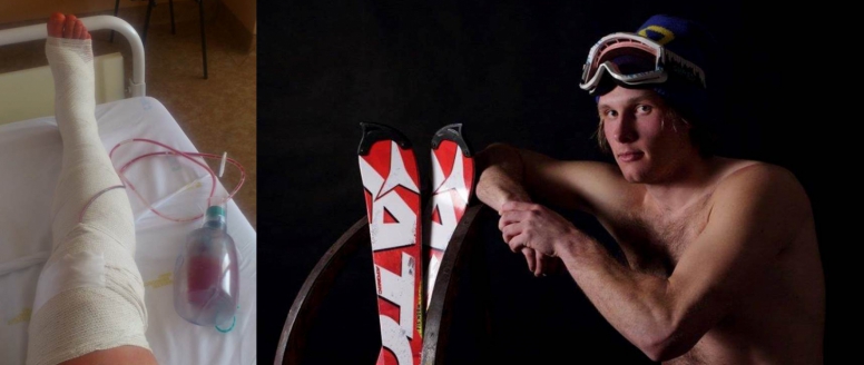 Návrat Berndta na lyže je odložen, v pravém koleni znovu prasklo